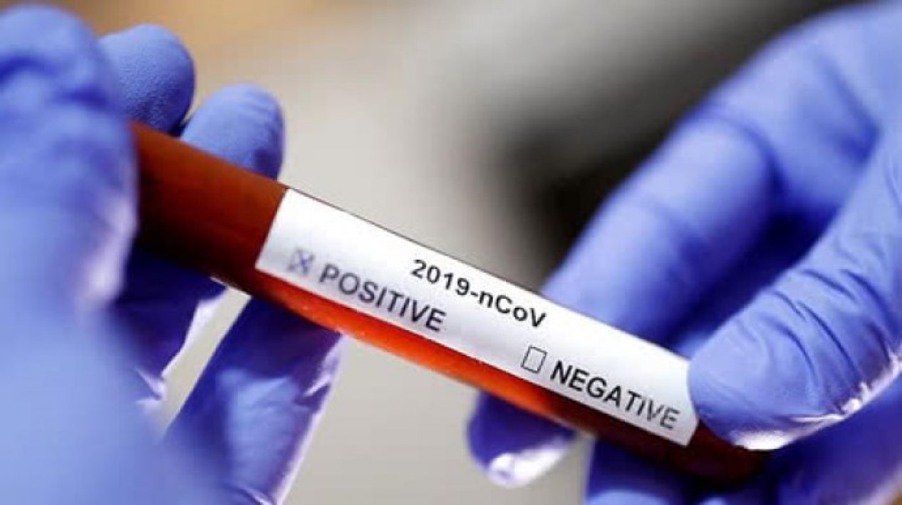 Millət vəkili: “Dünyada koronavirusa təkrar yoluxma halı 1 %-dən azdır”