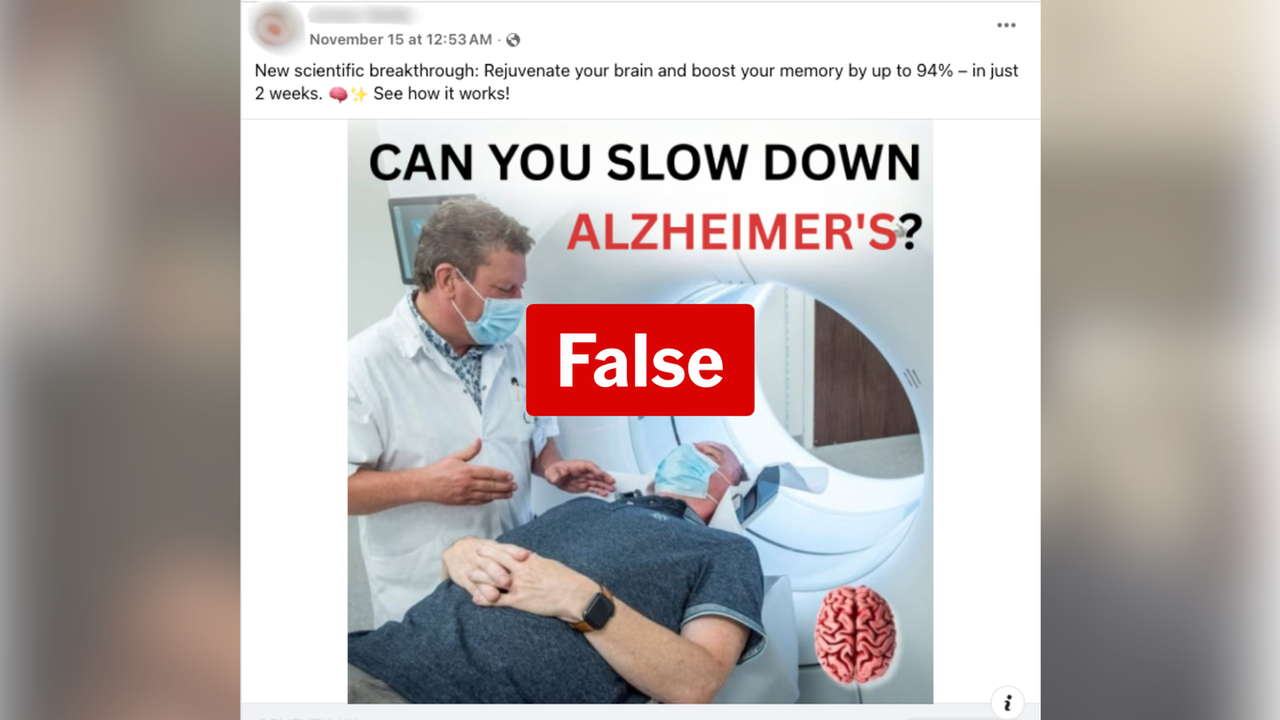 No medicines have yet been shown to slow down or reverse the progression of dementia. (AAP/Facebook)