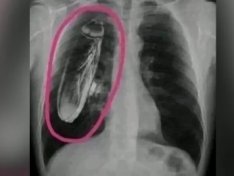 The Art of Baking: From Classic Bread to Artisan Pastries