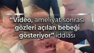 "Video, ameliyat sonrası gözleri açılan bebeği gösteriyor" iddiası