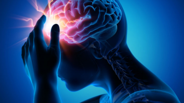 Miqren sadəcə güclü baş ağrısıdırmı? Elm onun səbəbi və müalicəsi barədə nə deyir...