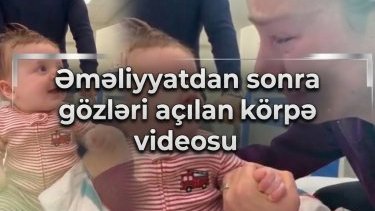 Əməliyyatdan sonra gözləri açılan körpə videosu həqiqdirmi?