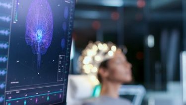 Rusiyalı mütəxəssis: “Koronavirusa yoluxan insanda erkən qocalma başlaya bilər”