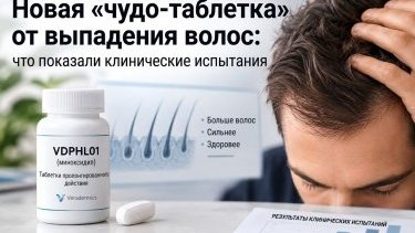 Новая «чудо-таблетка» от выпадения волос: что показали клинические испытания