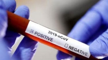 Millət vəkili: “Dünyada koronavirusa təkrar yoluxma halı 1 %-dən azdır”