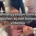 Əməliyyatdan sonra gözləri açılan körpə videosu həqiqdirmi?