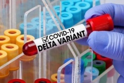 İnfeksionist: Tibbi maska  koronavirusun  “Delta” növünə  qarşı  tam təminat vermir