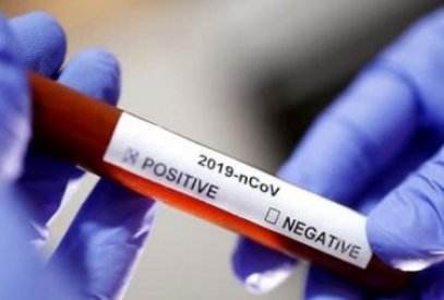 Millət vəkili: “Dünyada koronavirusa təkrar yoluxma halı 1 %-dən azdır”